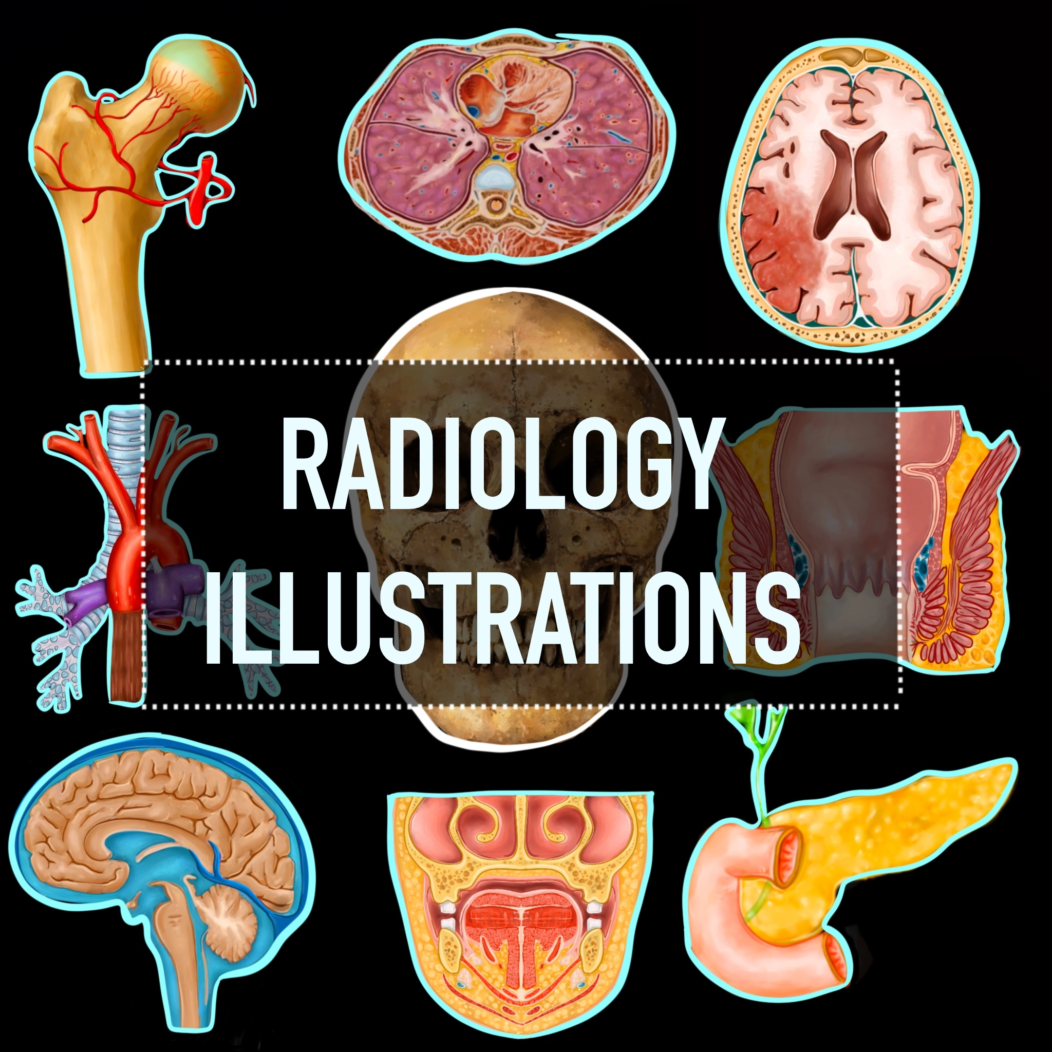 Example Radiological Classification Drawing Radiology Illustration